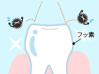 歯科医院でのフッ素塗布